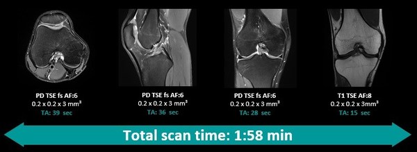 應用Deep Resolve，超高分辨率完整膝關(guān)節(jié)掃描可在2分鐘以內(nèi)完成，并提供高信噪比圖像
